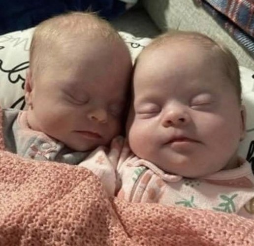 Florida Mom of Rare Twins with Down Syndrome Shares Their Beautiful Story
