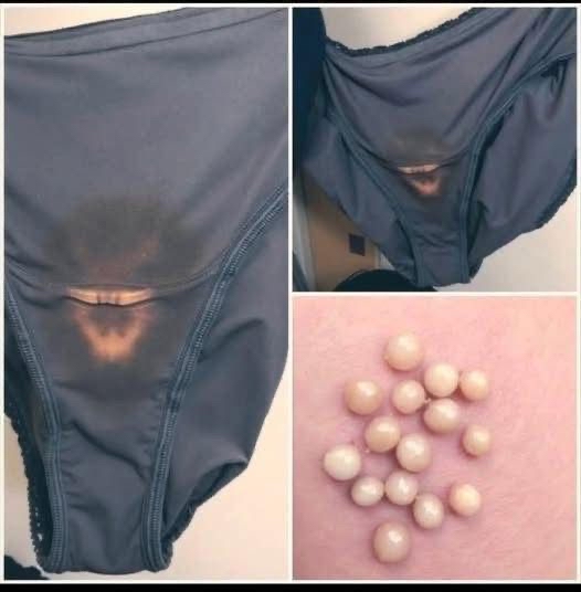 BE CAREFUL, if you notice this in your underwear, it means you have…Read more(Link in first comment )