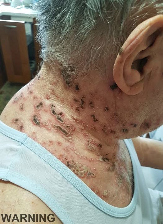 These are the first symptoms of sleeping with… See more