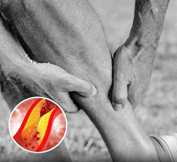 These Foot Symptoms Could Be a Sign of Clogged Arteries