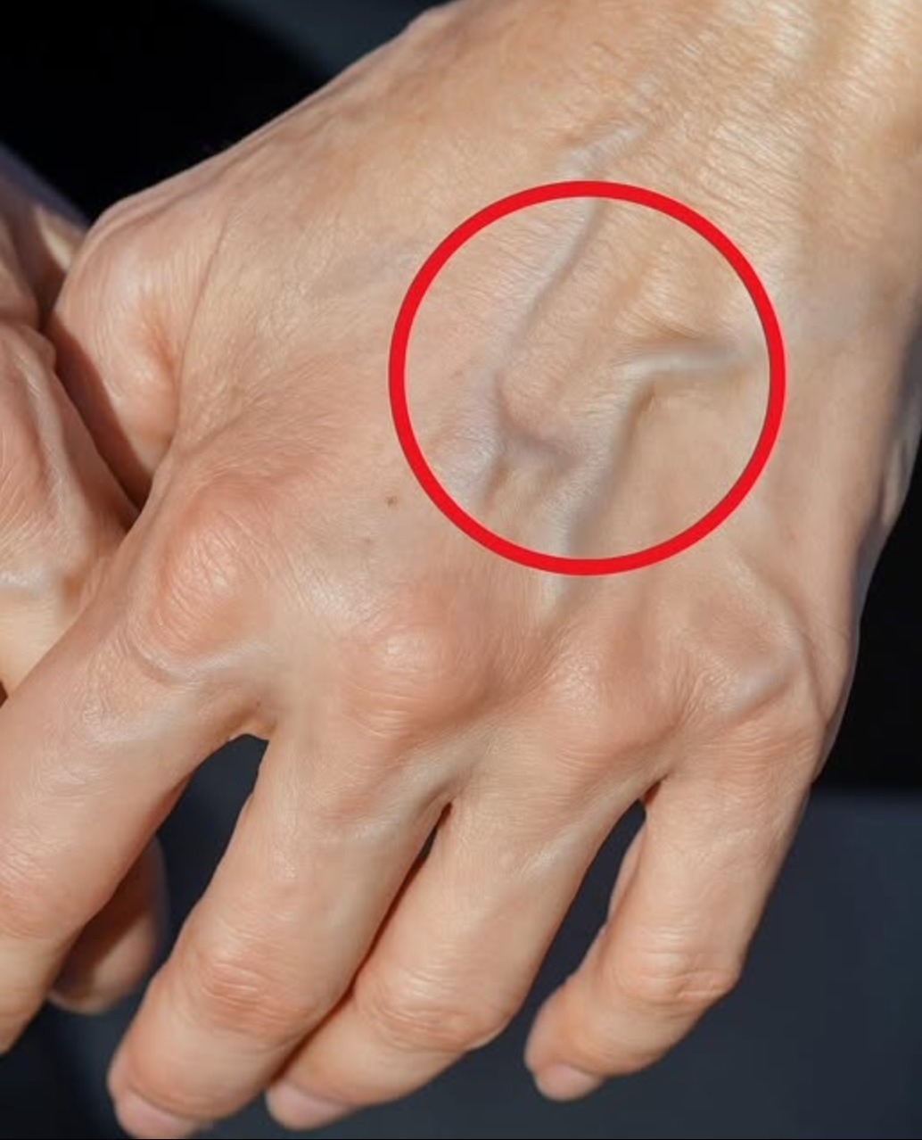 When New Veins Appear: Signs You Shouldn’t Ignore