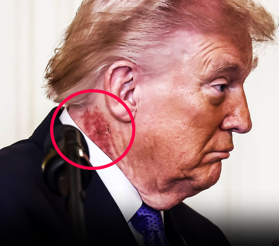 What People Are Talking About After Seeing Donald Trump’s Neck in Recent Images