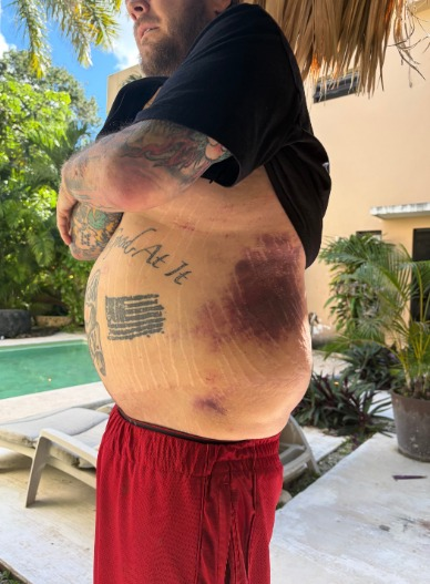 ‘Pawn Stars’ Star Corey Harrison Asks Fans for Support After Serious Motorcycle Accident