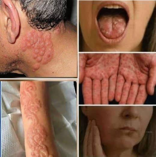 Search Results for: These are the signs that he is cr…