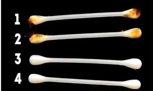 What Your Ear Health Can Reveal About Overall Well-Being-