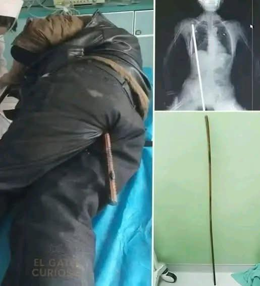 Young man hospitalized after being arrested