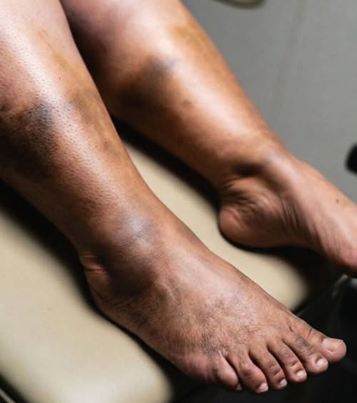 These are the consequences of sleeping with a …