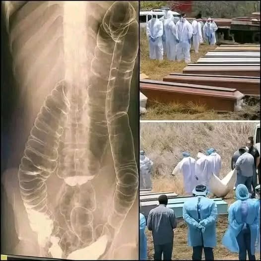 The Viral “Urgent Warning” Everyone Is Talking About…