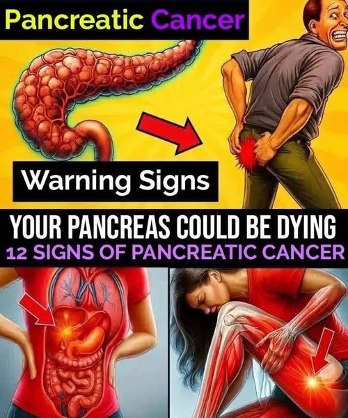 Signs of pancreatic cancer you shou