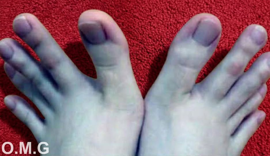 The Internet is going crazy over this lady\’s feet. Here\’s why.
