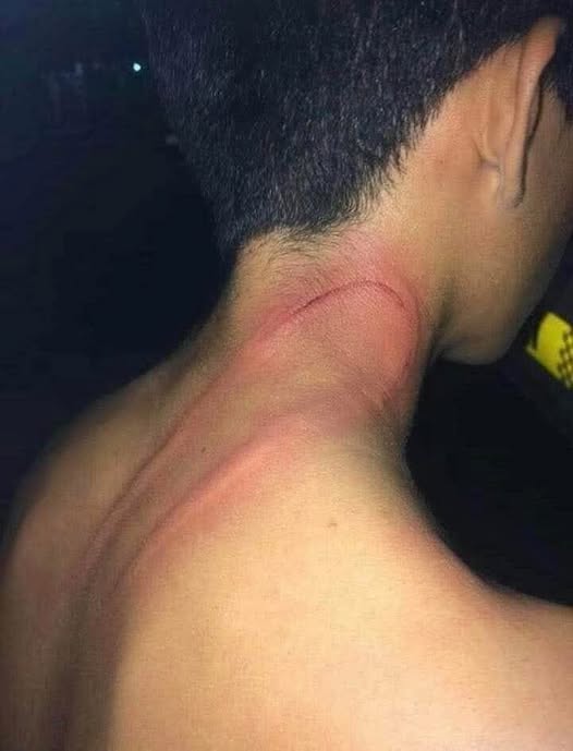 Young man beaten by his father…
