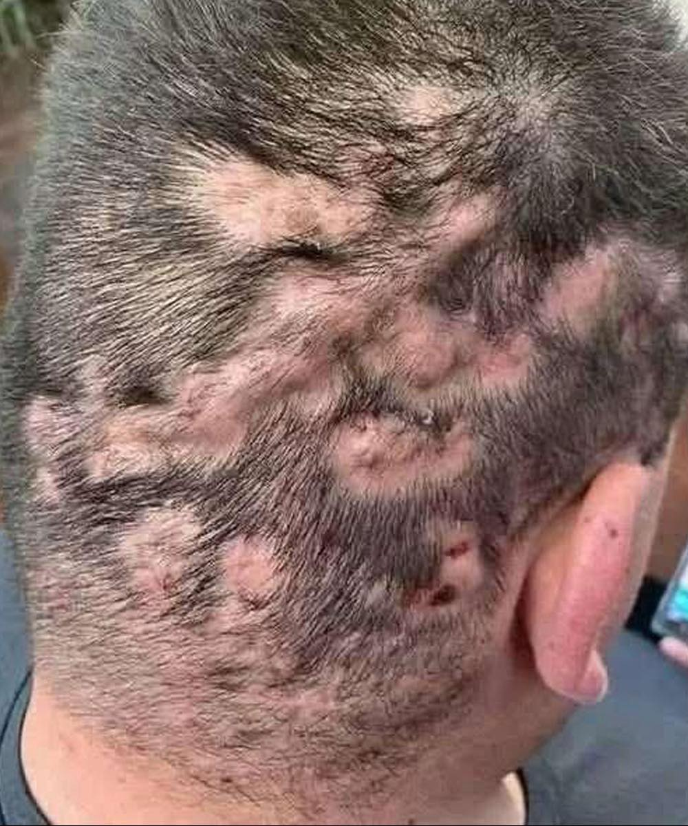 Recognizing the Early Symptoms: What You Need to Know