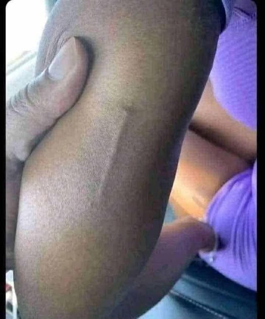 Found this in my girls arm still trying to figure out what it is?