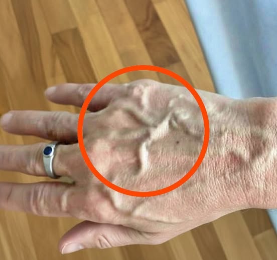If you have visible veins it means you aree…